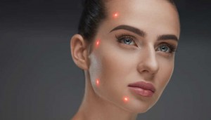 Closeup Of Beautiful Woman Face With Laser Points On Facial Skin